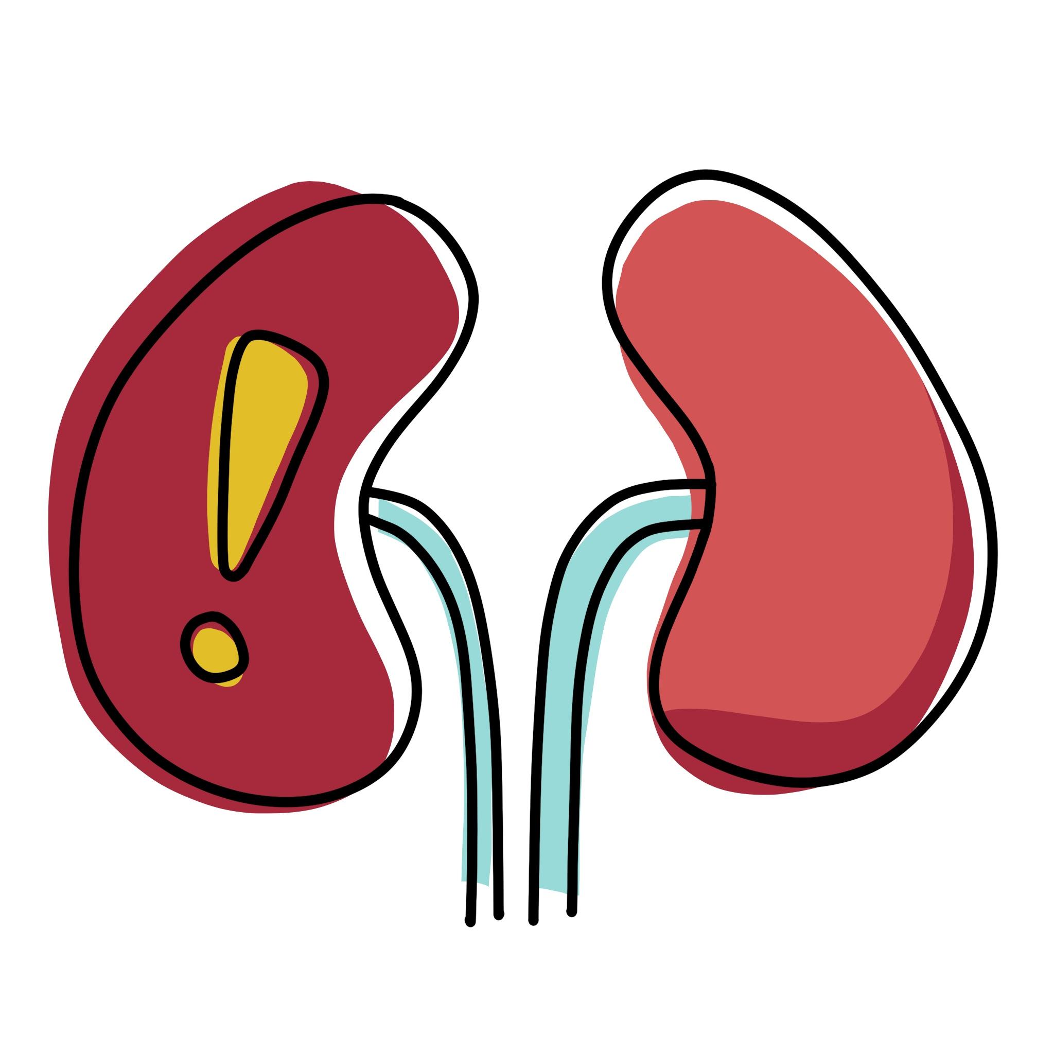 illustration of faulty kidneys